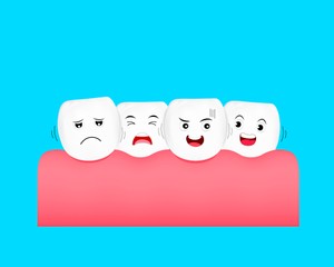 crowding teeth