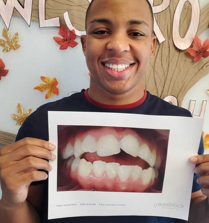 A patient named Jeremiah showing off his new smile next to a picture of his smile before