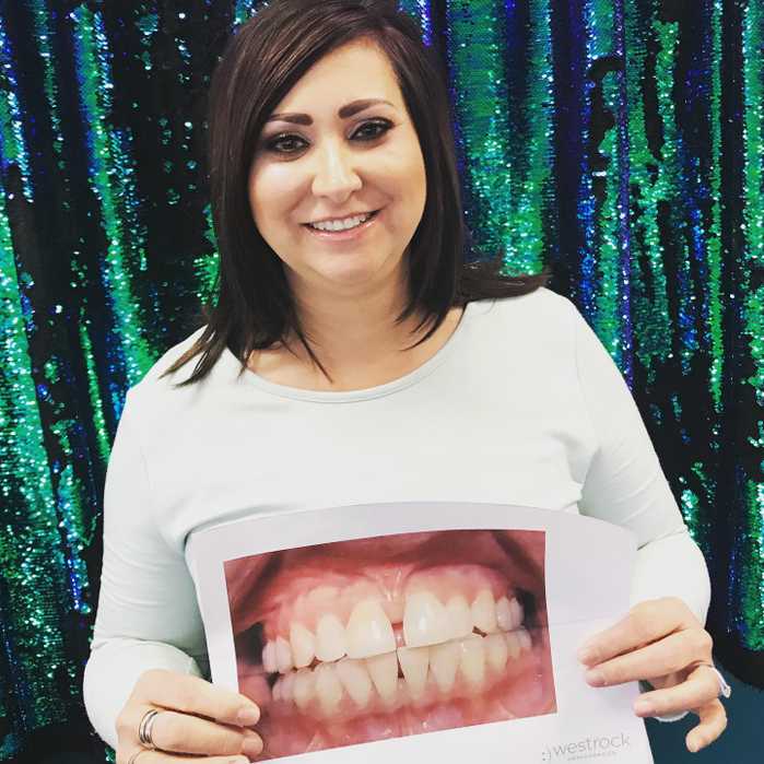 Heather showing off her new smile next to a picture of her smile before