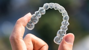 Clear Teeth Aligners: Your Path to a Perfect Smile
