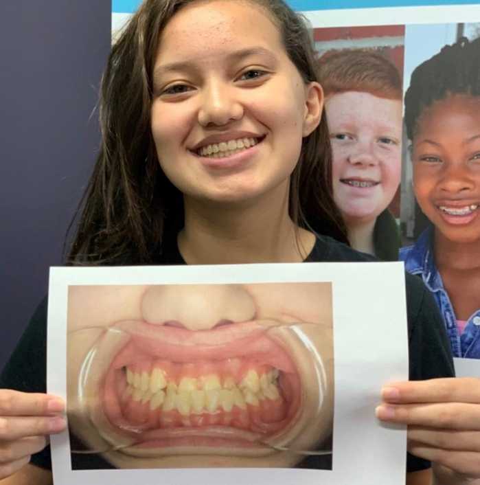 A patient named Mae showing off her new smile next to a picture of her smile before