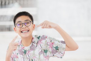 How much do braces cost?