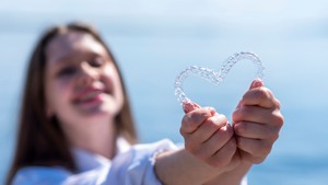 How Long Do People Wear Clear Aligners