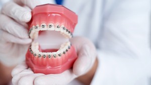 can you get braces with periodontal disease