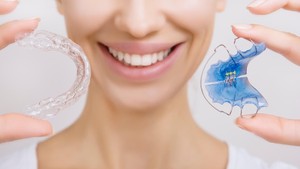 How Long Does It Take to Make a Retainer