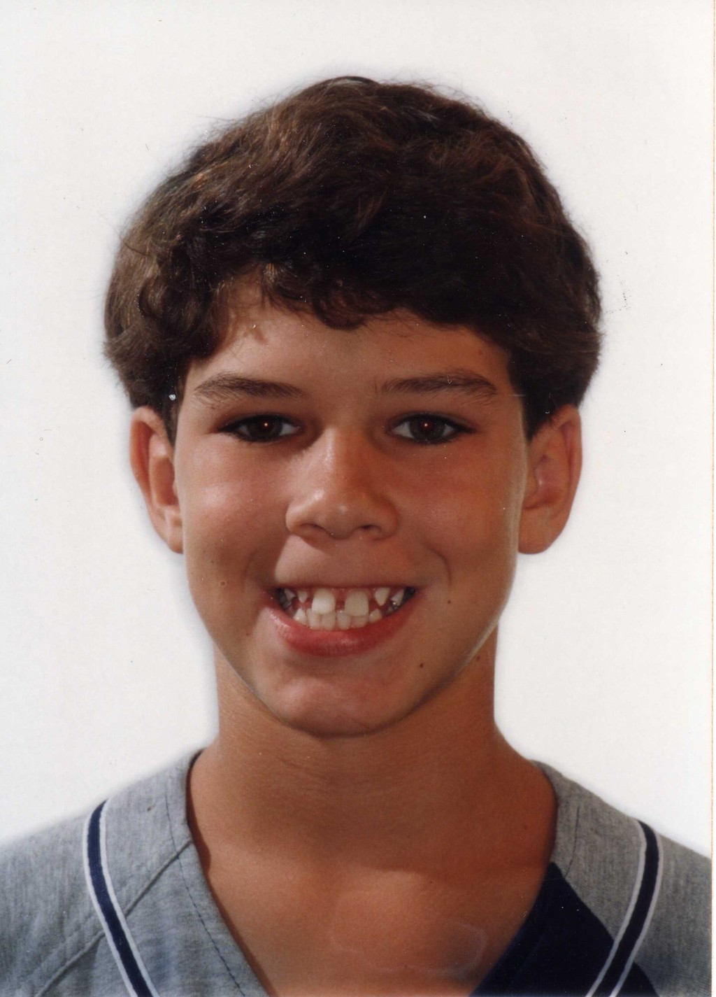 a patient with buck teeth