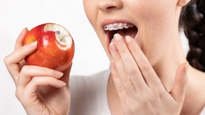 food you can't eat with braces