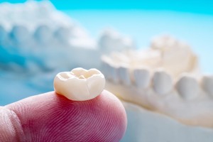 Dental Crowns and Braces