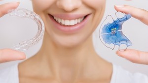 invisalign vs retainer