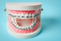 Orthodontist Near Sullivan, MO