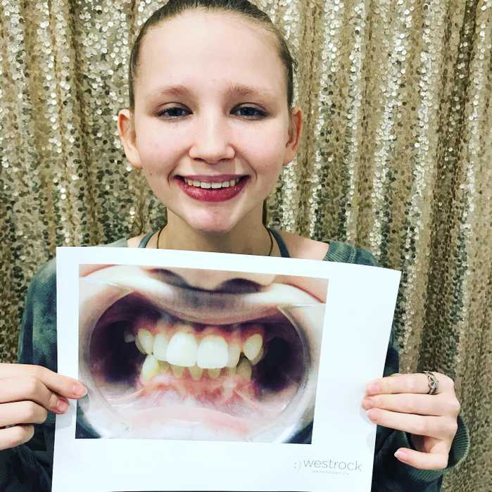 A patient named Darla showing off her new smile next to a picture of her smile before