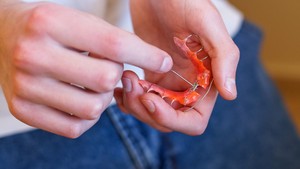 Are Maxillary Expanders Necessary