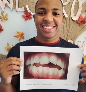 Find out how long does It take for teeth to shift with braces from an orthodontist at Westrock Orthodontics.