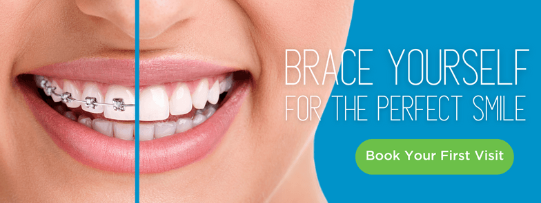 Traditional Metal Braces Graphic
